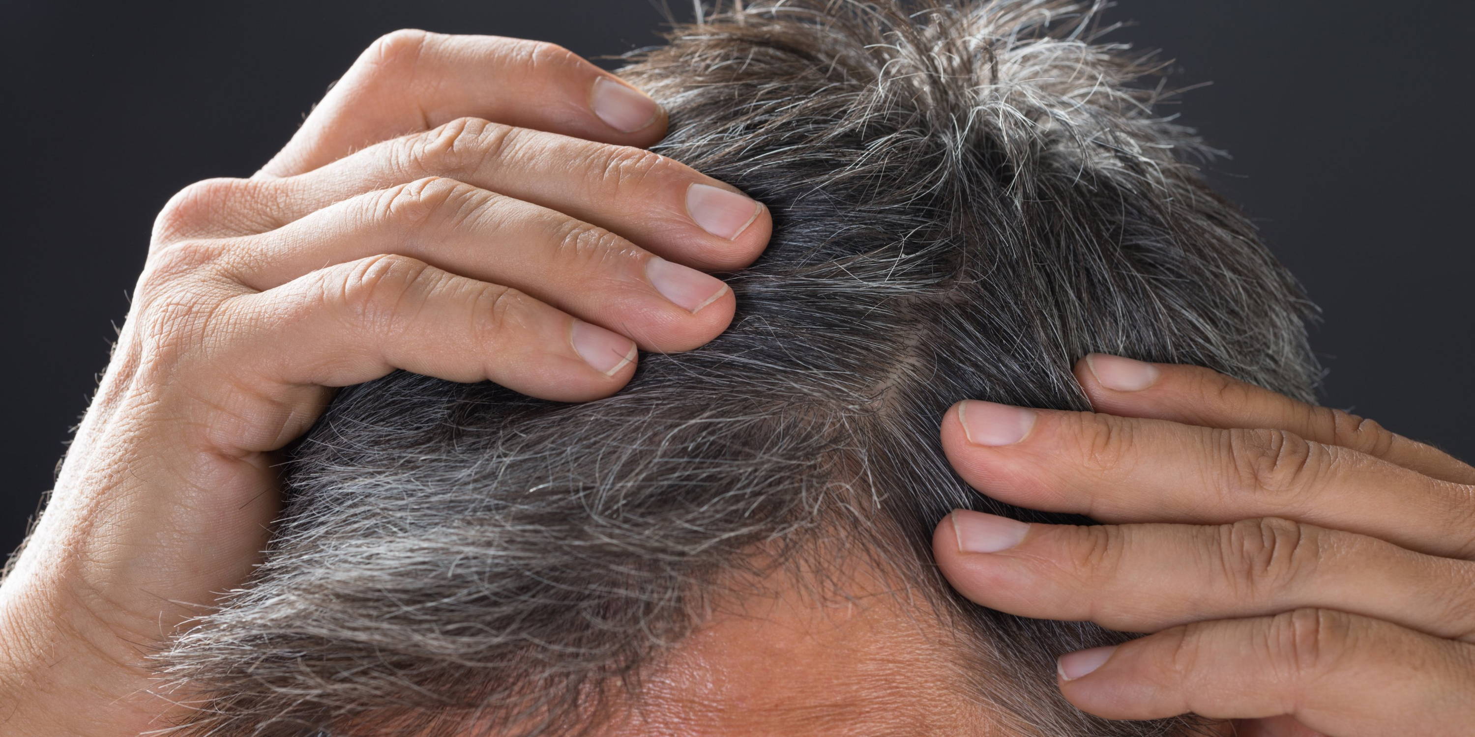 [TOP3] How to Stop Hair Falling (Hair Loss) [For MEN] Topkapi Inc